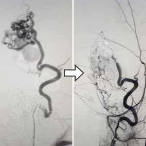 Vascular Treatments Offered