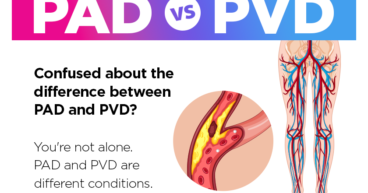 pad vs pvd