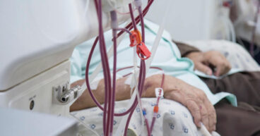 Central Venous Catheters