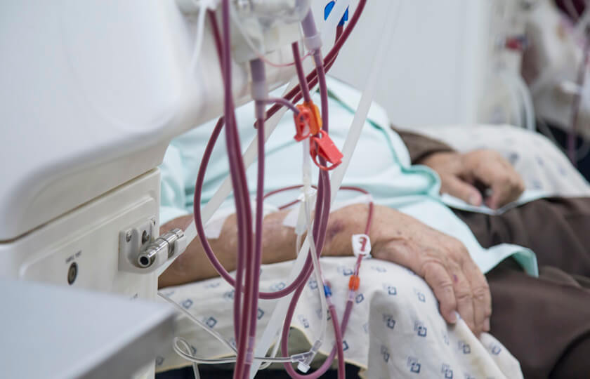 Central Venous Catheters vs. AV Fistulas: Benefits, Risks & Outcomes