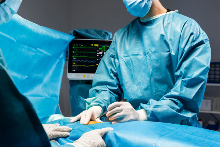 Glue Technology for Varicose Vein