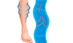 Vascular Diseases-01