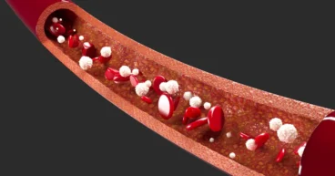 Tips to Improve Blood Circulation