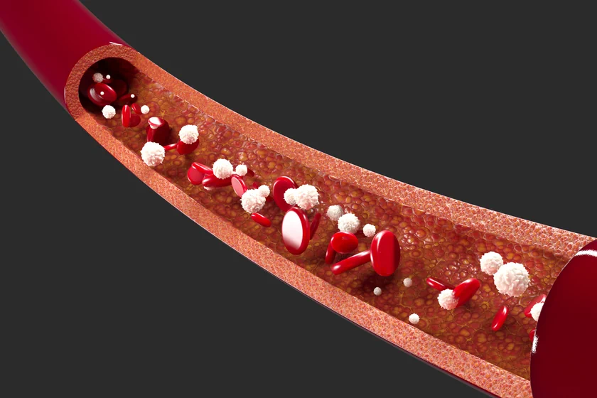 Tips to Improve Blood Circulation